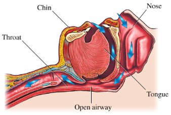 apnea-norm