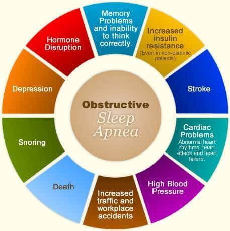 Obstructive Sleep Apnea