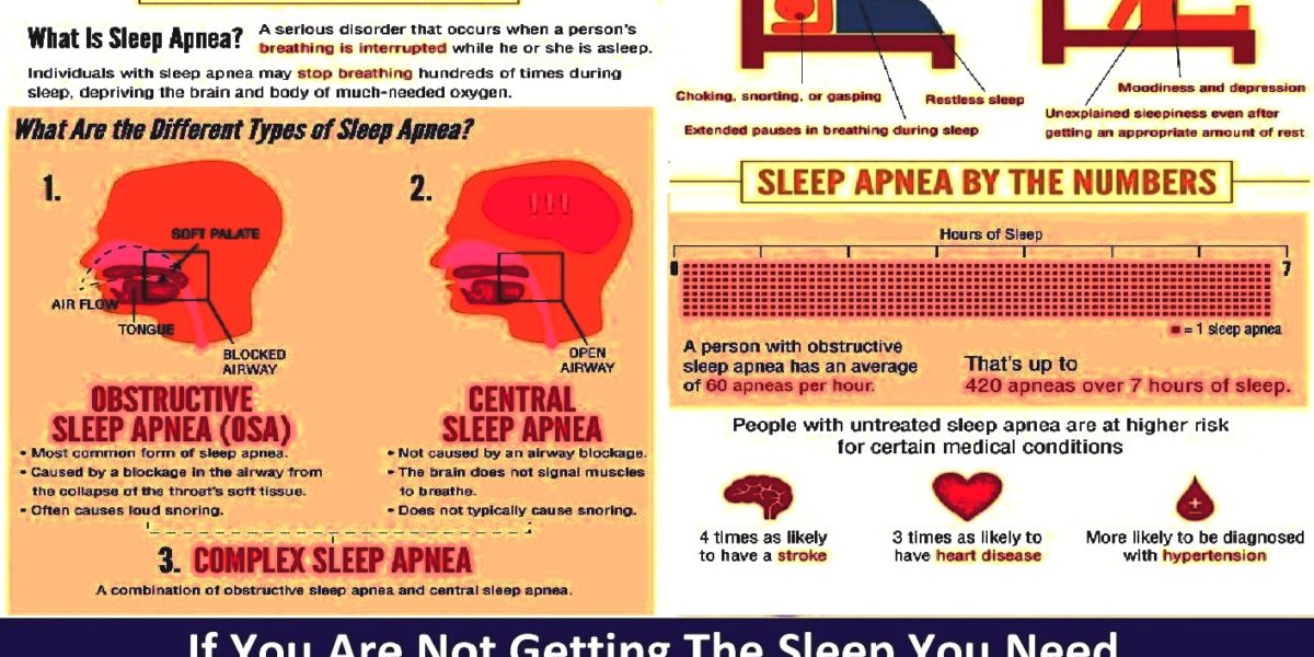 Sleep Apnea – Understanding the Basics