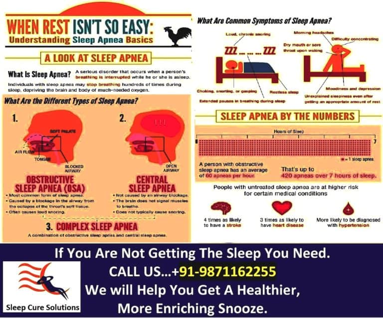 Sleep Apnea Understanding the Basics Sleep Cure Solutions