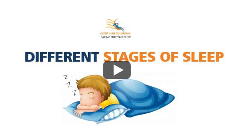 Different Stages of Sleep - sleep cure solutions